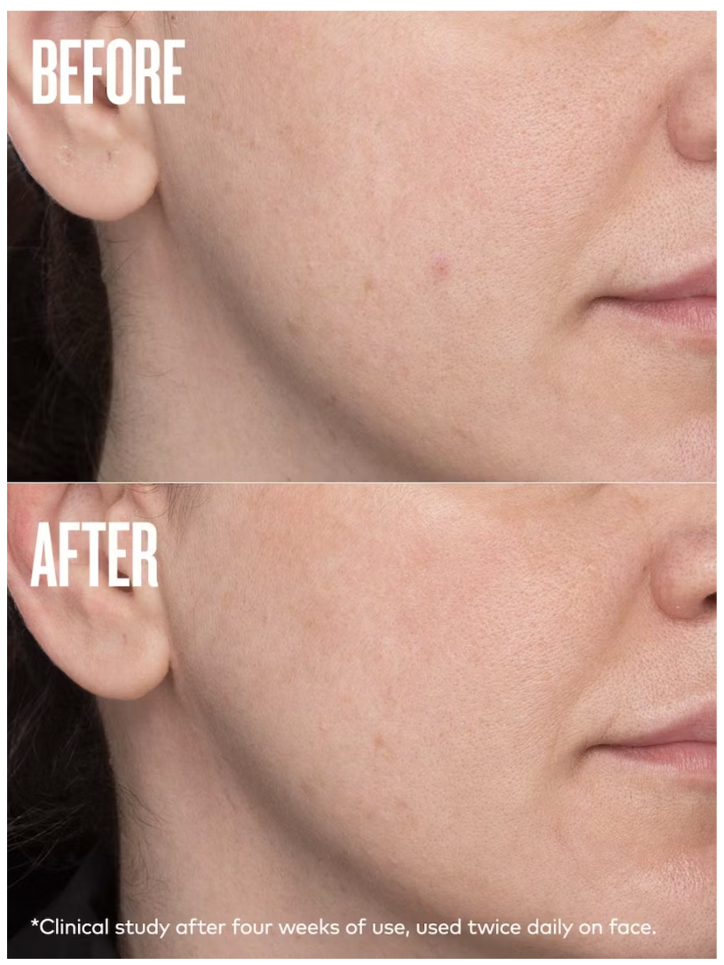 after results of using Beautycounter All Bright Dark Spot Minimizer  on the cheeks 